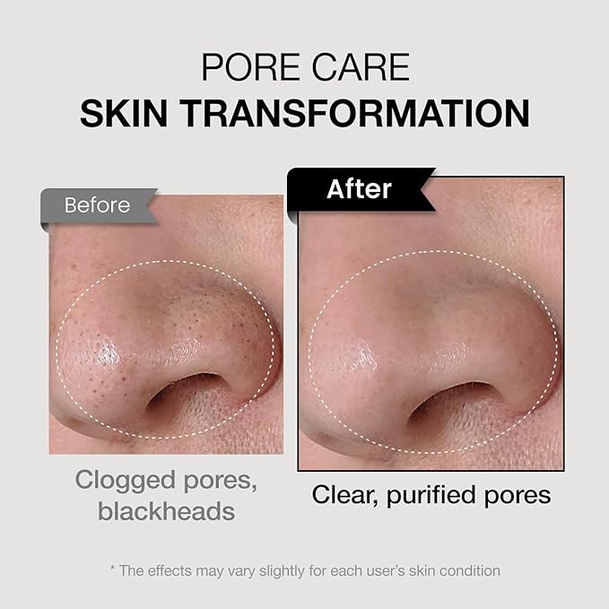 coxir TXA MUCIN ALL-IN-1 PORE MASK –Gelato Texture Wash-Off treatment | Ampoule Mask-to-Foam | Charcoal+ Snail+TXA | Blackhead Remover |Daily Pore Detox for Oily & Sensitive Skin|4.05fl.oz