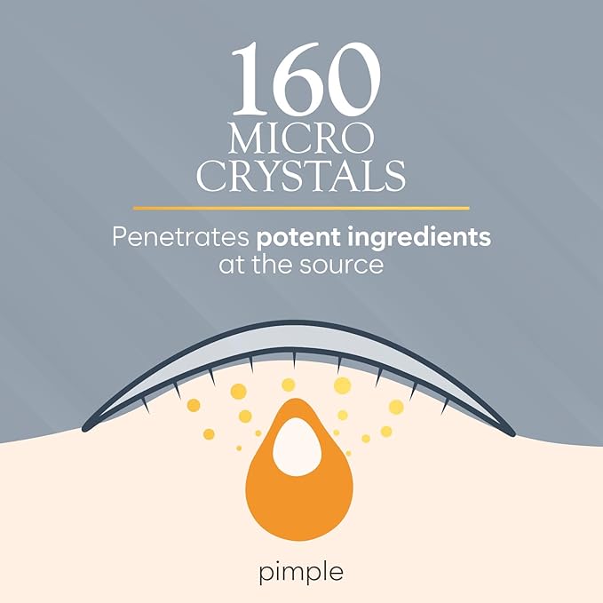 Microdart Acne Patch, Zit Patches for Cystic Acne Overnight Care, Cystic Acne Coverage, Pimple Patches Microdart Technology - Salicylic & Hyaluronic Acid (12 Count)