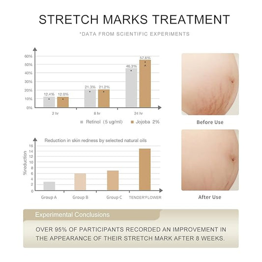 Stretch Mark Oil（110ml）, body oil for Pregnancy,belly oil, belly abdominal Serum Skin Care,Moisturizing Dry Skin, Tender & Softening，True Belly Serum 3.7OZ