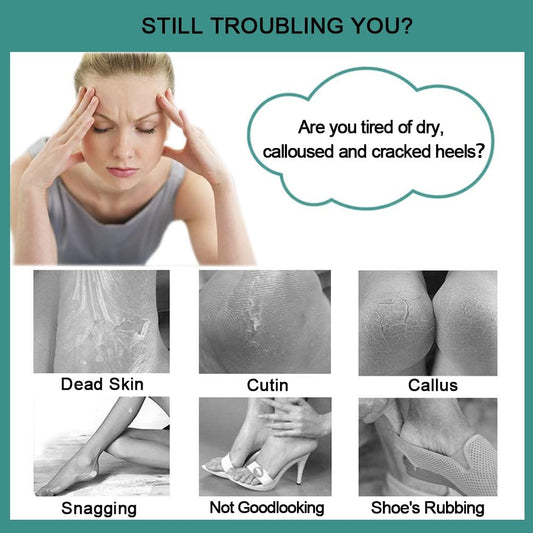 CAREHOOD Foot File Callus Remover - Multi Purpose 4 in 1 Feet Pedicure Tools with Foot Scrubber, Pumice Stone, Foot Rasp and Sand Paper for Home Foot Care (Grey Pedicure Foot File)