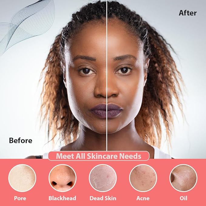 Facial Cleansing Brush | 3-in-1 Electric Face Scrubber | USB Rechargeable Face Cleansing Brush | IPX7 Waterproof | Blackhead Remover | Deep Cleansing & Exfoliating (Pink)