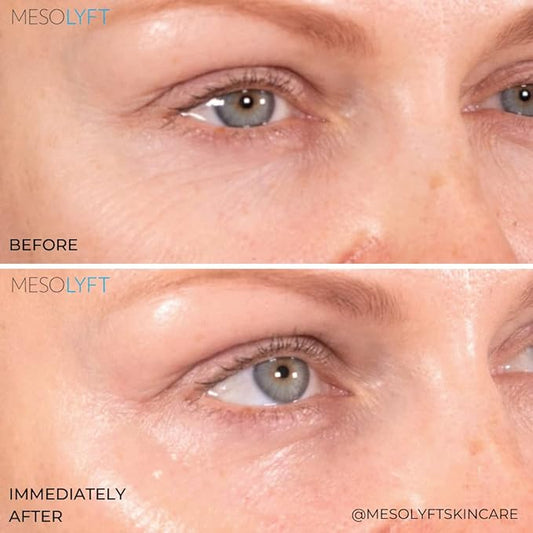 Power Combo Neck & eye Roller Brightening Face Serums for Anti-Aging Get Lip Pump's best Lip Plumper an Effectively Aging Skin Serum Multi-purpose, Eyes Neck & Décolleté Beauty Serum