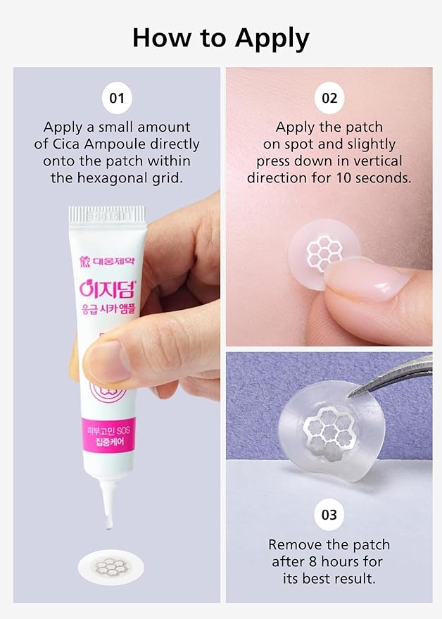 EasyDerm Quick Calming Magnesium Patches – Hydrocolloid Acne Spot Treatment Includes Tweezers & Ampoule, 10 Patches, Zit Sticker, Back to School MUST HAVE, Made by Daewoong Pharmaceutical