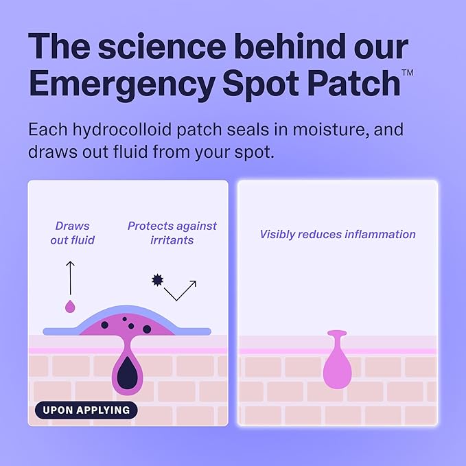 Curology Emergency Spot Pimple Patches for Face, Hydrocolloid Pimple Patches Fast-Acting, 80 Count