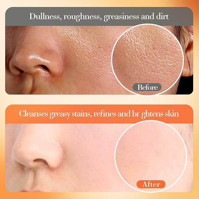 Vitamin C skin routine kit for women - face wash and moisturizer set - facial kit for women -toner face wash serum eye cream