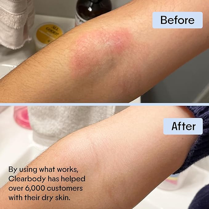 Clearbody Manuka Honey Eczema Cream – Organic Eczema Honey & Collodial Oatmeal Moisturizer for Soothing, eczema, Dry & Itchy Skin – Face & Body Lotion - Plant-Based Formula (2oz)