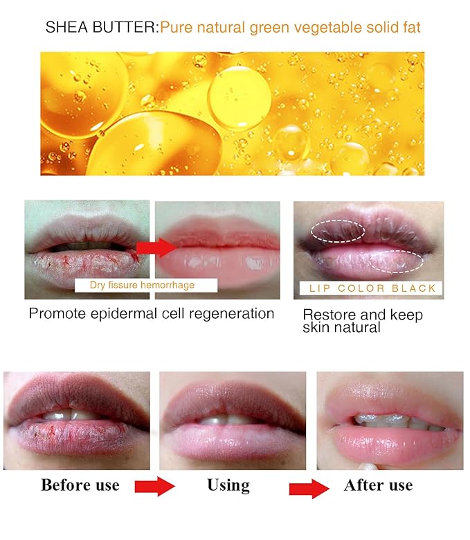 Moisture Lip Balm Lip Cream Hydrate Smooth Shea Butter Extract for Removing Dark Lip Promoting Skin Regeneration Making Lip Soft Tender & Autumn Winter Season Women Man Girl Boy Daily Lip Care