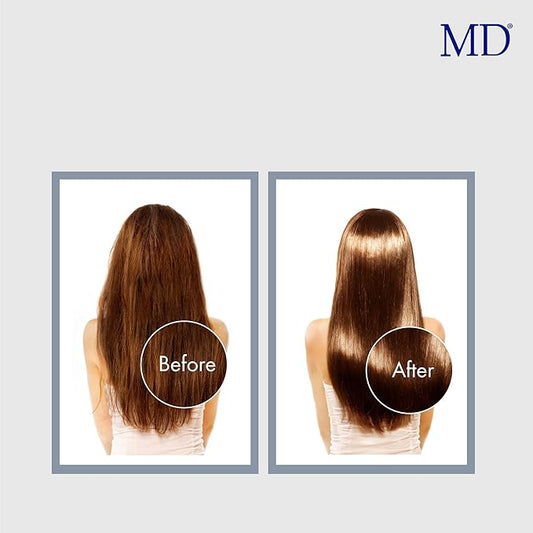 MD Revitalizing Shampoo for Men & Women – Sulphate-Free Hair Thinning Shampoo with Aloe Vera, Chamomile – Hair Loss, Regrowth Anti Thinning Shampoo for All Hair Types