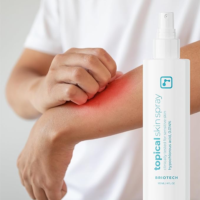 BRIOTECH Topical Skin Spray, Hypochlorous Acid Spray for Sensitive Skin, HOCl Facial Mist, Full Body Support Against Irritation, Calm Redness, Soothe Foot & Scalp, 8 oz (1 Pack)