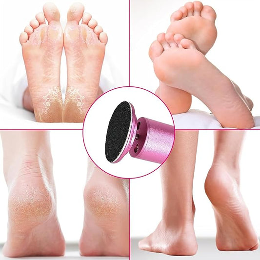 Electric Foot Callus Remover, Adjustable Foot Speed, Professional Foot Repair Tool, Equipped with 60 Pieces of Sandpaper, Suitable for Men and Women with Dead Skin calluses, Dry and Cracked, Pink