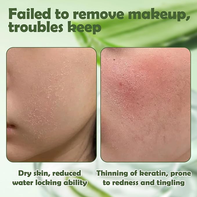 Total Takeoff Waterproof Makeup Remover – Dual-Phase Oil & Water Formula, Removes Eye & Lip Makeup, Gentle for Sensitive Skin, Aloe & Argan Oil, No-Rinse, 3.4 fl oz/100ml