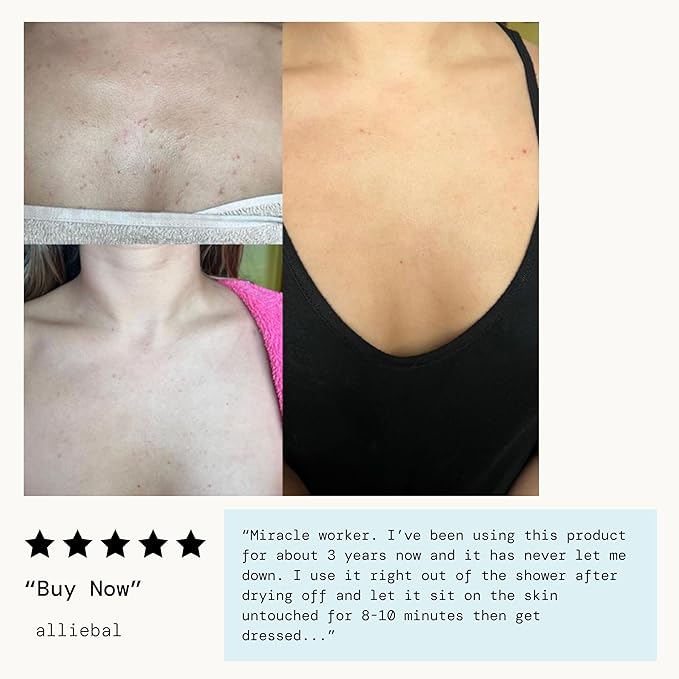 Pacifica Bacne Acne Cleanser Spray - Bacne Warrior - Body Spray for Acne Treatment - w/ 2% Salicylic Acid Niacinamide & Aloe - for Body, Chest & Back Acne for Teens & Adults Vegan Dermatologist Tested