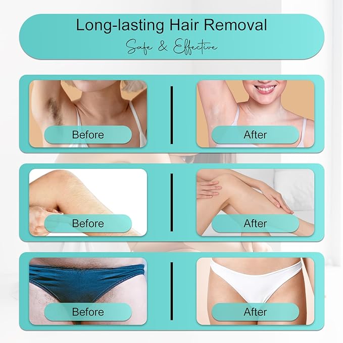 Professional IPL Laser Hair Removal Device & Epilator for Women and Men, 999,999 Flashes, Permanent Hair Reduction for Face, Legs, Arms, Bikini Line & Body, Painless Treatments for Smooth Skin at Home