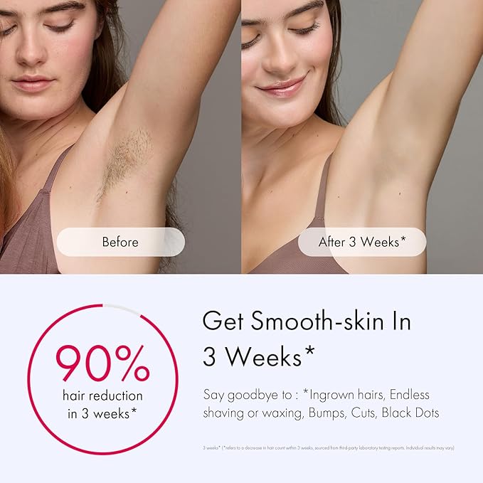 Ulike Laser Hair Removal for Women and Men, Air 3 Ice-Cooling IPL Device Hair Removal for Nearly Painless & Long-Lasting Results, 3 Modes & Auto Flashing for Fast Full Body Hair Removal from Home