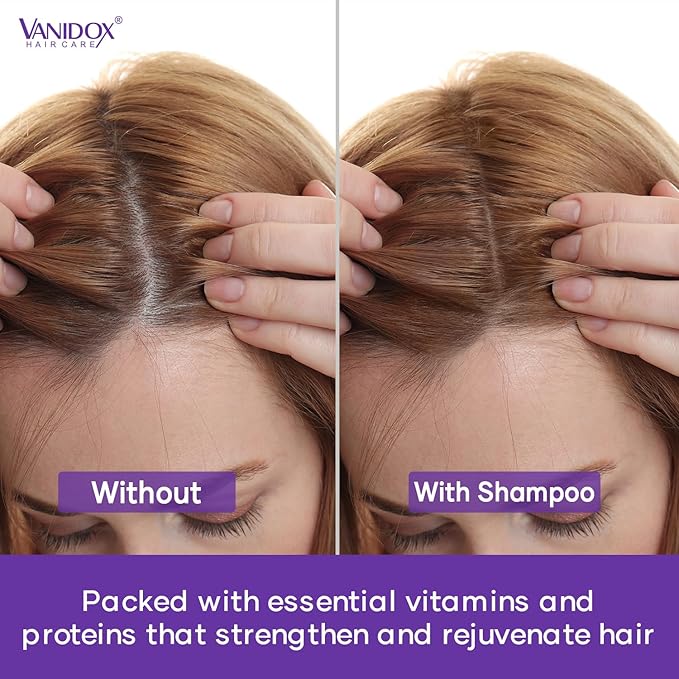 Tea Tree Shampoo and Conditioner Set with Lavender and Mint | DHT Blockers | With 100% Pure Tea Tree Oil for Itchy, Dry Scalp | Sulfate & Paraben Free | For Men & Women | 16 fl oz Each