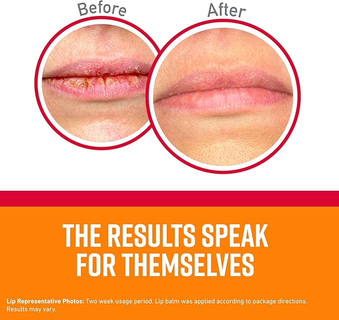 O'Keeffe's Medicated Lip Repair Seal & Heal Lip Protectant, Stick, (Pack of 2)