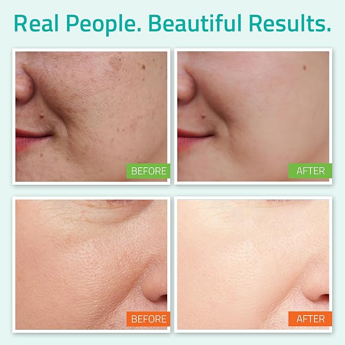 YEOUTH Skin Care Set: Hyaluronic Acid Serum with Vitamin C, Face Toner, Face Moisturizer, Skincare Kit for Hydrating and Smooth Looking Skin, Facial Kit 3-Piece