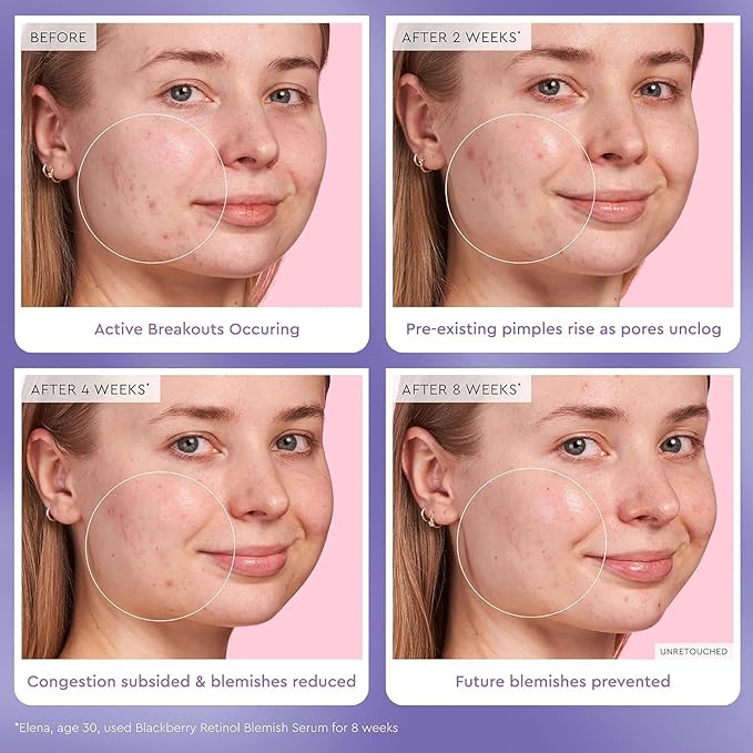 Glow Recipe Glass Skin Hydration Travel Size Korean Skincare Set - Includes Mini Cloudberry Facial Toner, Strawberry Blur Drops, Blackberry Retinol Serum & Pink Juice Moisturizer (4 Count)