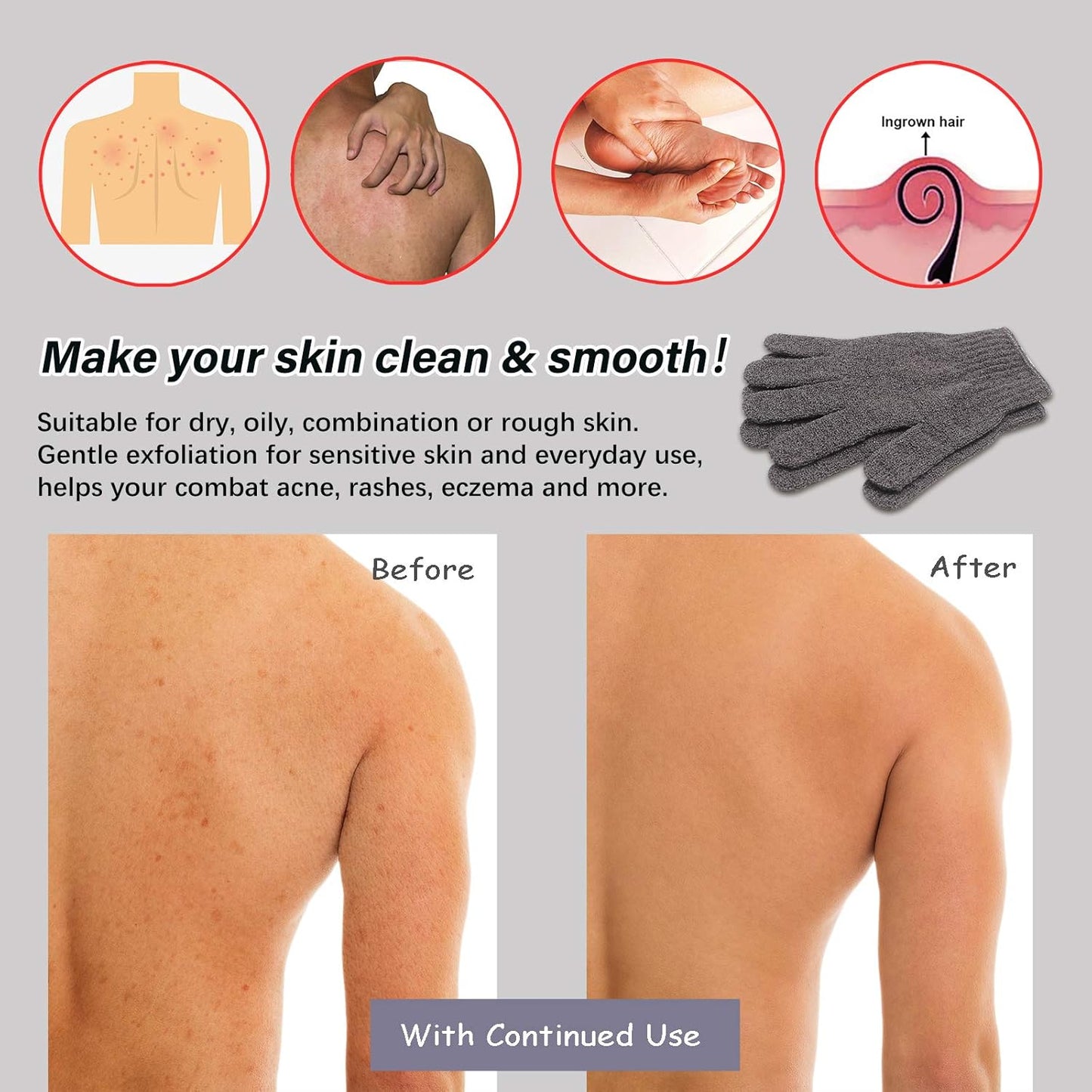 MIG4U Shower Exfoliating Scrub Gloves, Bathing Gloves Body Wash Dead Skin Removal Deep Cleansing Sponge Loofah for Women Men