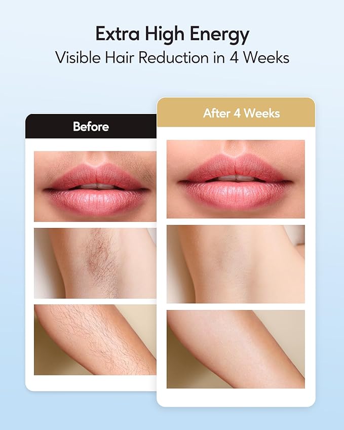INNZA IPL Hair Removal with Ice Cooling Care Function for Women,Long-Lasting Results,999,999 Flashes Painless IPL Hair Remover, Hair Removal Device for Armpits Legs Arms Bikini Line