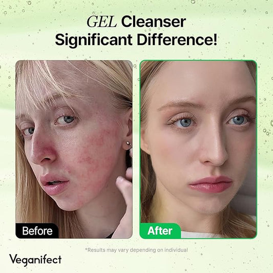 Gel Cleanser, Big Size, Gentle Exfoliation and Face cleanser for Sensitive Skin, Korean Skin Care, Vegan, 6.93 Fl Oz