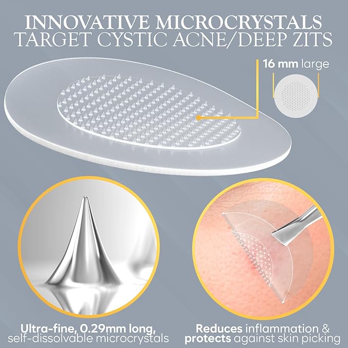 Microdart Acne Patch, Zit Patches for Cystic Acne Overnight Care, Cystic Acne Coverage, Pimple Patches Microdart Technology - Salicylic & Hyaluronic Acid (12 Count)