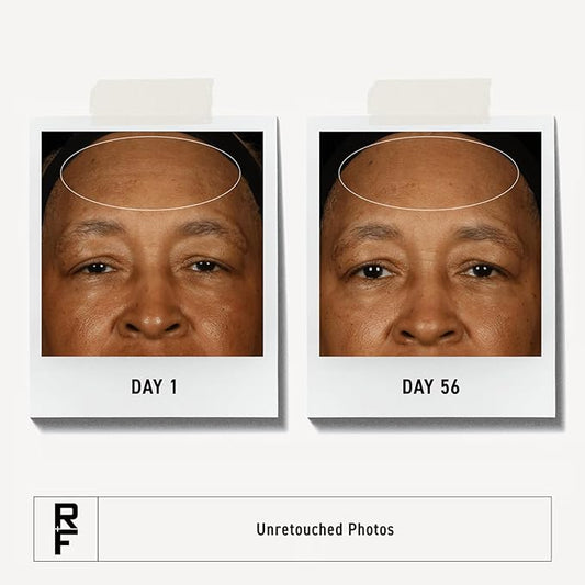 Rodan + Fields Redefine Regimen | Skincare Kit Includes Clay Cleanser, Toner, Triple Defense Cream, & Overnight Cream | Skin Care Gift Set for Women