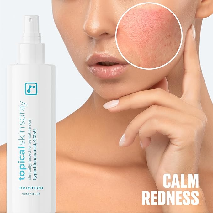 BRIOTECH Topical Skin Spray, Hypochlorous Acid Spray for Sensitive Skin, HOCl Facial Mist, Full Body Support Against Irritation, Calm Redness, Soothe Foot & Scalp, 8 oz (1 Pack)