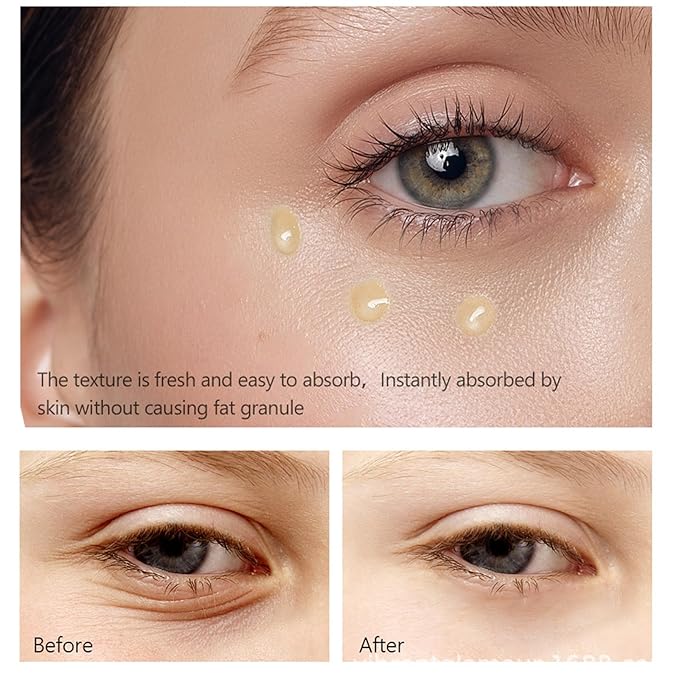 Retinol Eye Serum Anti Aging Under Eye Cream Visibly Reduces Wrinkles Fine Lines in 4-8 Weeks - Tightening Firming with Double Retinol 30ml