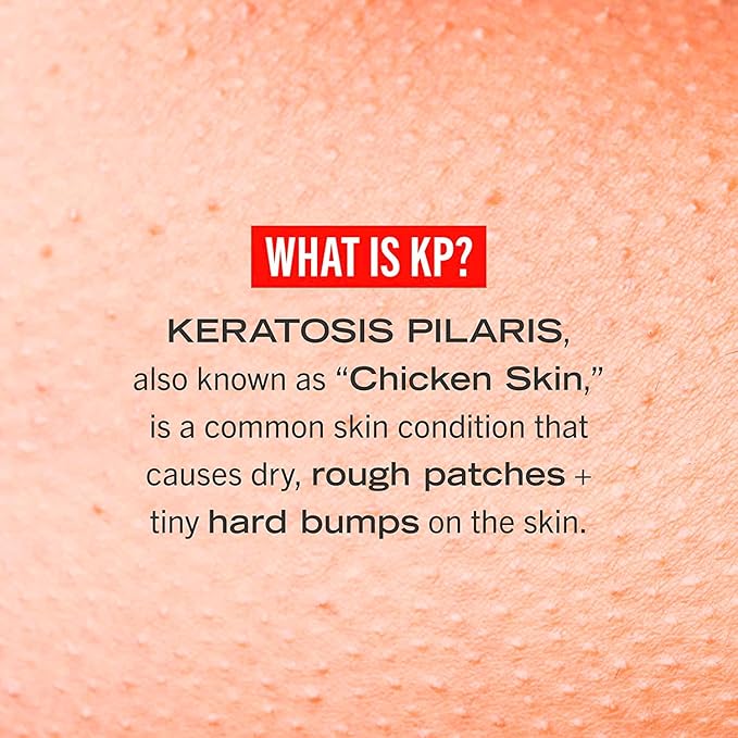 First Aid Beauty KP Bump Eraser Body Scrub Exfoliant for Keratosis Pilaris with 10% AHA – 8 oz + Bonus 1 oz Travel Size Tube