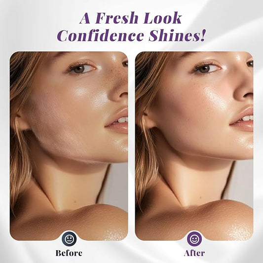 Dermaplaning Tool for Women - Facial Exfoliation & Peach Fuzz Hair Removal with Rechargeable Sonic Edge Technology, 10 Refill Blades