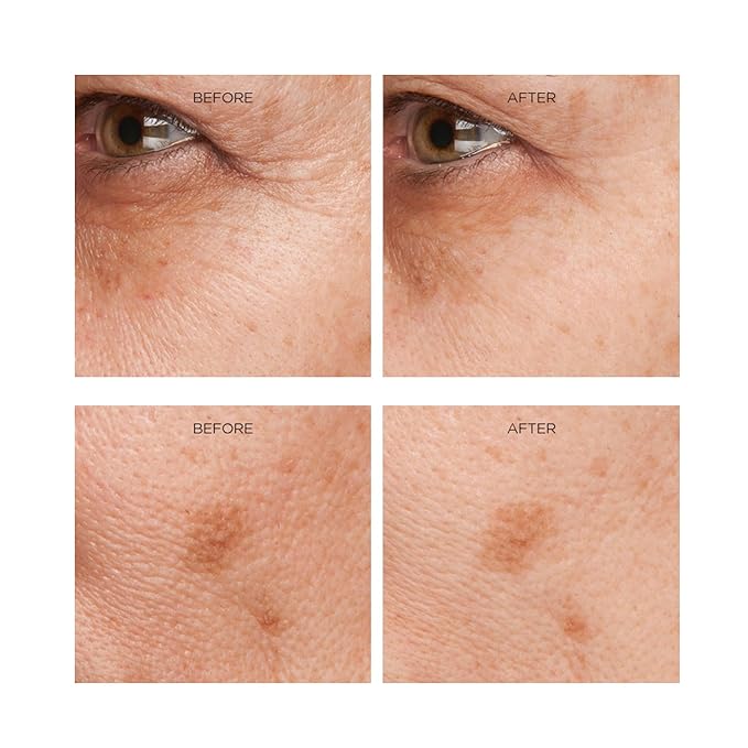 Rejuvenation Serum for Line Lifting and Crow's Feet
