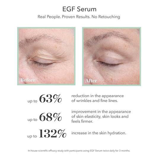 BIOEFFECT EGF Serum & Hydrating Cream with Hyaluronic Acid in a Water Based Formula for a Dramatic Moisturizing Boost, Target Wrinkles & Signs of Aging for a Glowing, Hydrated & Youthful Complexion