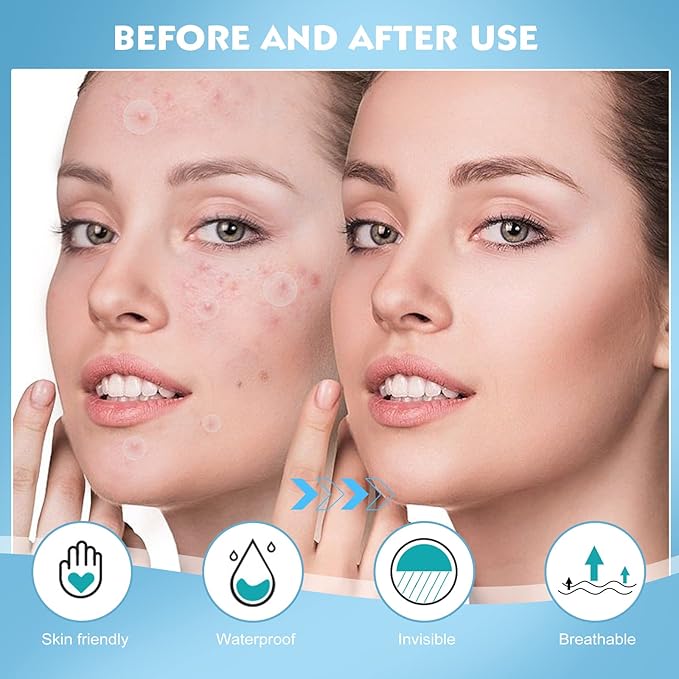 Pimple Patches for Face - 180 Hydrocolloid Acne Pimple Patches Salicylic Acid with Tea Tree Oil for Zit Blemish Spot Covers Invisible Pimple Stickers Not Tested on Animals