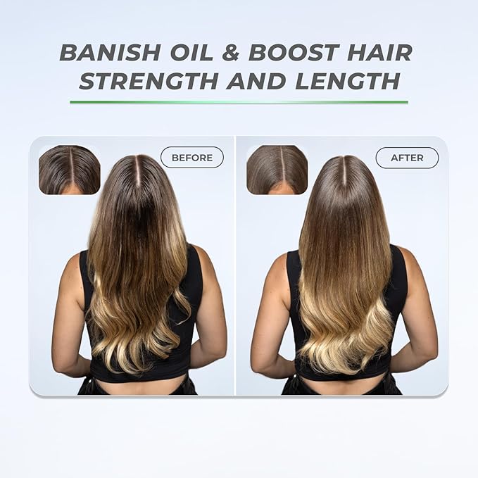 XMONDO Hair BOOST X Dry Shampoo, Zero Residue, Formulated with Saw Palmetto to Promote Scalp Care, Clinically Tested, Dermatologist Tested, Talc-free, Benzene-free, Free of aluminum starch, 5 oz