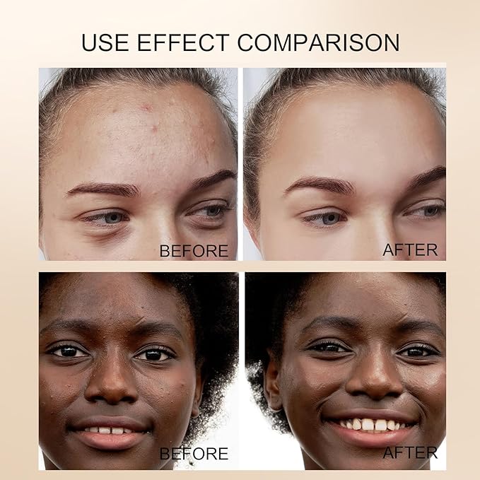 FLOWER SECRET PURE PEARL LADY SKIN CARE SET (FLOWER SECRET Seven-piece set)