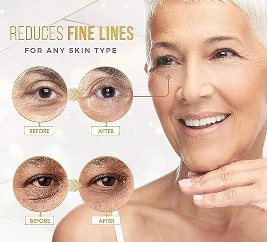 24k Gold Eye Treatment Masks With Collagen