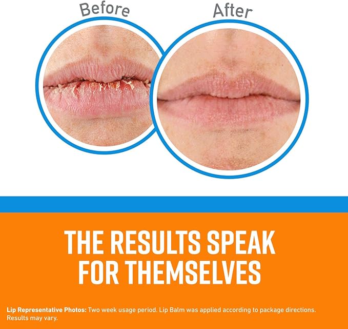 O'Keeffe's Cooling Relief Lip Repair Lip Balm for Dry, Cracked Lips, Stick, (Pack of 9)