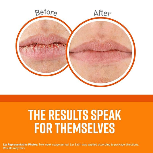 O'Keeffe's Unscented Lip Repair Lip Balm for Dry, Cracked Lips, Stick, (Pack of 10)