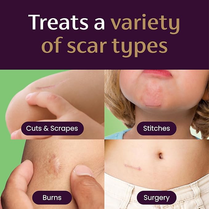 Mederma Scar Gel for Kids - Reduces Appearance of Old & New Scars from Cuts, Burns, Surgery, Insect Bites & Scrapes, Grape Scented, Goes on Purple & Rubs in Clear, Ages 2+, 0.70 Oz