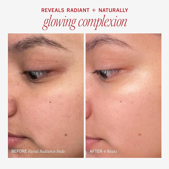 First Aid Beauty – Facial Radiance Pads with Glycolic & Lactic Acids, Daily Exfoliating with AHA that Helps Tone & Brighten Skin, Makeup Prep Pads, Compostable for Daily Use, 60 Count, 2ct