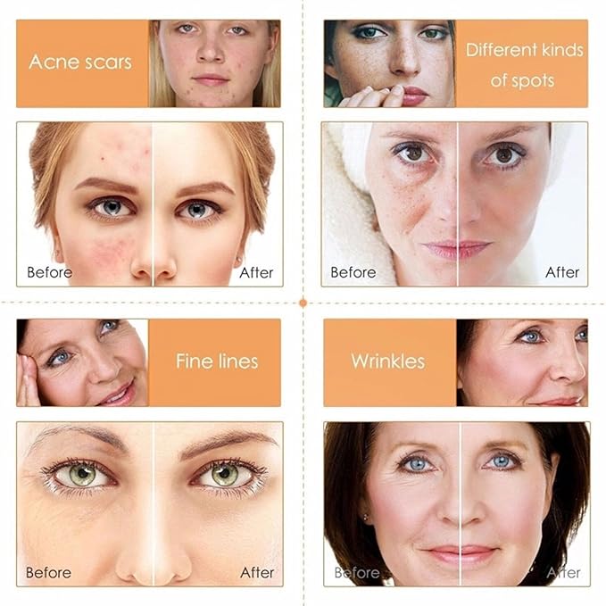 Vitamin C 5-Piece Skincare Set with Cleanser, Toner, Serum, Eye Cream and Face Cream for Skin Brightening skin care set skincare gift set skin care set for Unisex Adult