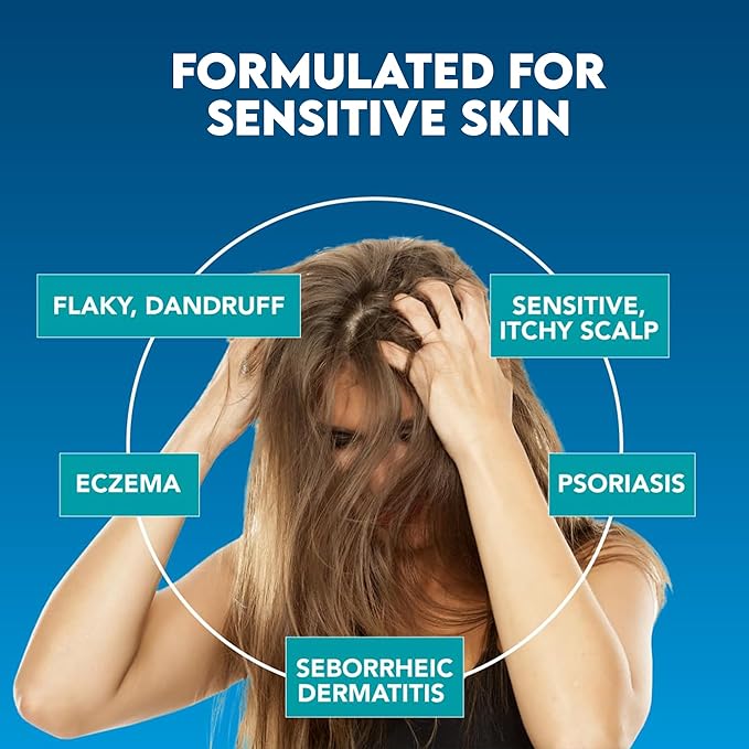 Rapid Itch Relief Anti-Dandruff Scalp Spray Moisturizer, Dry Scalp Spray, Cooling Itchy Scalp Treatment for Flaky Sensitive & Psoriasis, Derm-Formulated. Menthol & 5 Ceramides, 1.35 fl oz