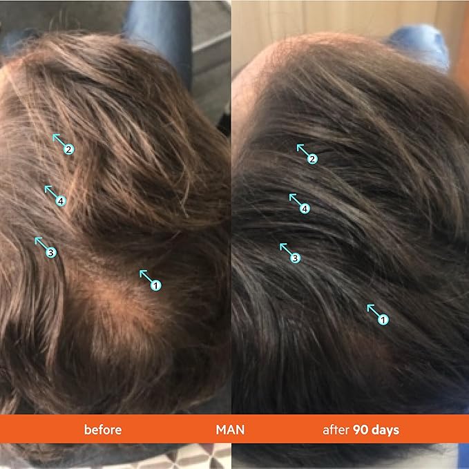 DS Labs Revita Shampoo Travel Size – High-Performance Hair Density Shampoo, Volumizing & Thickening, Fuller, Healthier-Looking Hair, Sulfate & Silicone Free, For Men & Women, 100mL