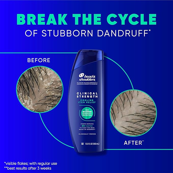 Head & Shoulders Clinical Strength Dandruff Shampoo, Selenium Sulfide Dandruff Defense, Intensive Itch Relief, Seborrheic Dermatitis Relief, Cooling Menthol, 13.5 Fl Oz Each, 2 Pack