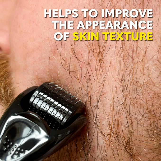 The Beard Club Derma Roller for Face, Body and Scalp - Microneedling for Men and Women with 540 Titanium Microneedles - Beard Roller & Micro Needling Scalp Hair - Black & Yellow