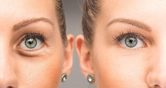 Anti Aging Eye Cream, Bright Eyes, Daily Wrinkle Cream for Firming, Dark Circles, Puffiness