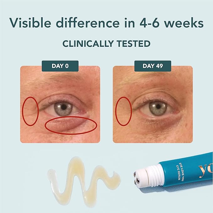 YOURS Eye Serum with Caffeine & Antioxidants | Hydrates and Brightens Under Eye Area | Restores Skin Firmness and Reduces Appearance of Fine Lines