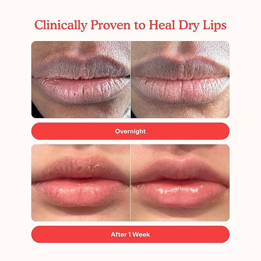 Tower 28 LipSoftie Hydrating Lip Treatment Balm, Moisturizing Lip Mask for Chapped Lips - SOS Vanilla Flavor, Clear Gloss