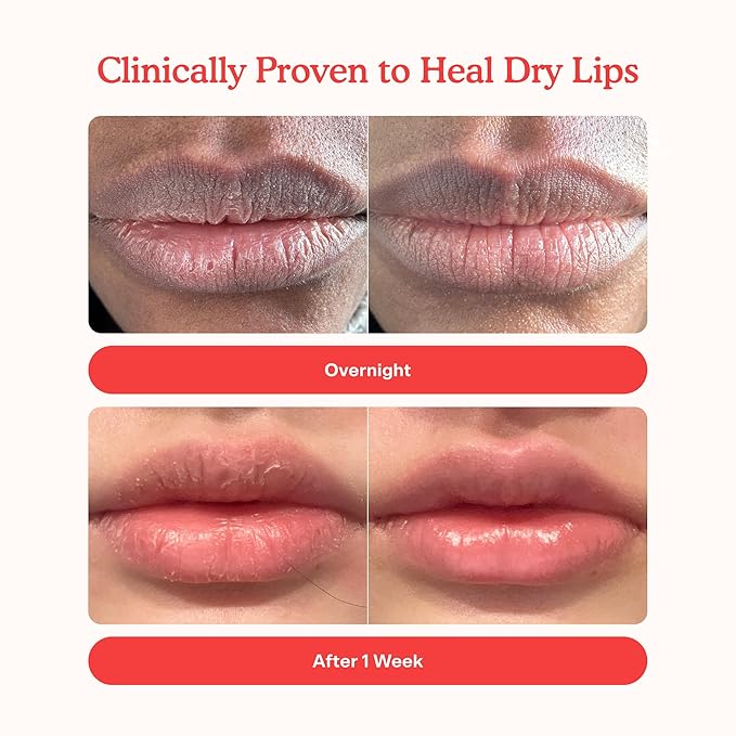 Tower 28 LipSoftie Hydrating Tinted Lip Treatment Balm, Moisturizing Lip Mask for Chapped Lips - Confetti Cake, Sheer Lavender Pink